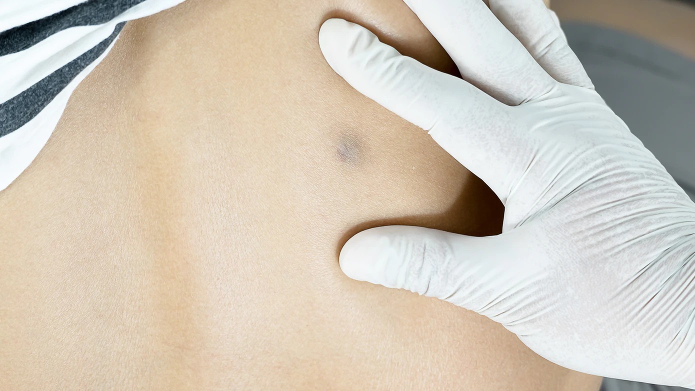 world-cancer-day-10-early-symptoms-of-cancer-that-you-should-not-ignore