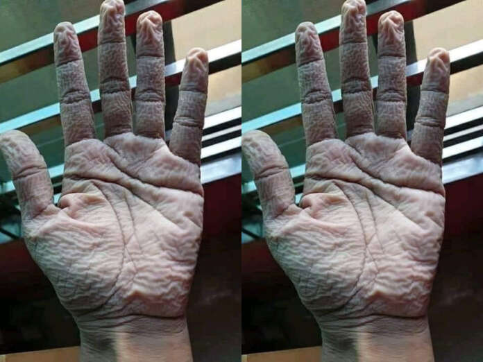 Corona workers hands