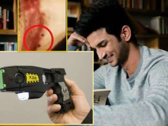 Sushant Was First Paralyzed With A Stun Gun, Claims American Doctor