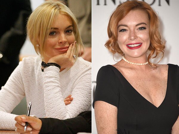 Cosmetic Surgeries