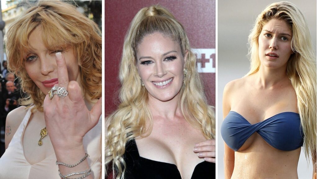 Cosmetic Surgery of Actresses