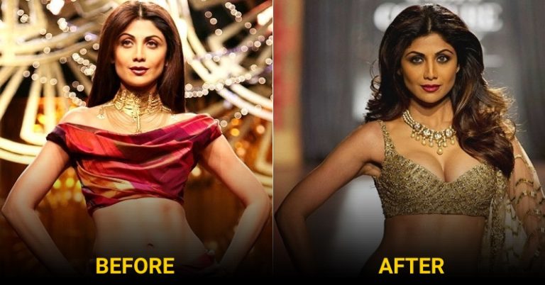 Bollywood Actresses Who Went For Breast Implants