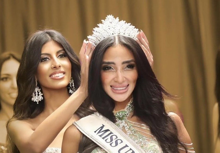 First Miss Universe Contestant With Vitiligo