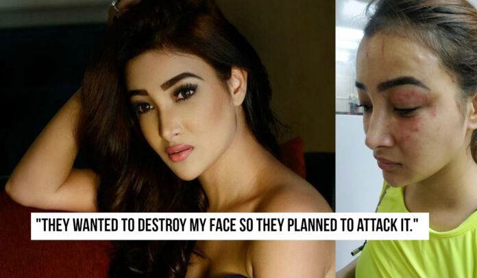 TV Actress Nalini Negi Physically Assaulted by Her Roommate Preeti Rana And Her Mother